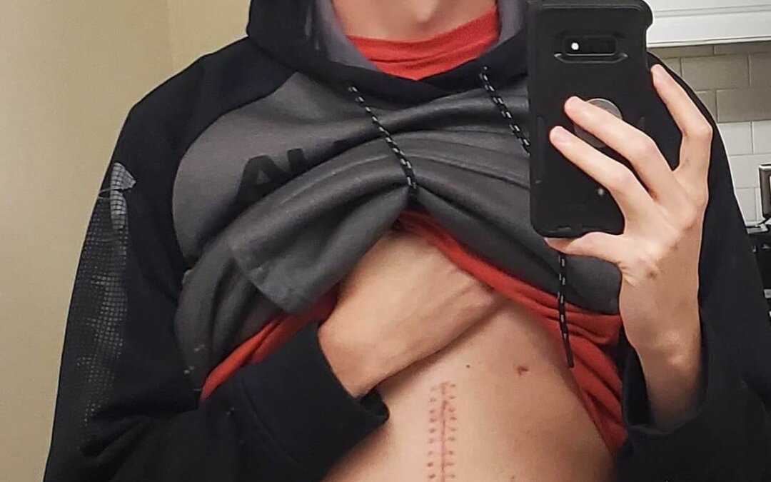 An Uncommon Diagnosis: Richmond Man’s Case Highlights Medical Issue